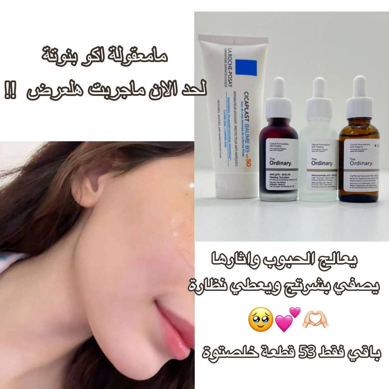بناتتت 😭🫶🏻🎀 سويت مسابـقـة بمتجري على بكج glow skin 💘☁ كريم سيكا بلاست مع سيرومات the ordinary أول 5 بنات يكتبن تم راح يفوزن بـ هدية وتوصيل مجاني لكل الـمحافظات 🎁🫰🏻
✨ يخفف الـحبوب والآثار والتصبغات
✨ يعطي نضارة ولـُمعة يهدئ ويرمم بشرتج. ⏰ ينتهي اليوم !!  اول 5 يكتبن "تم" خاص يفوزون 🫰🏻🐇​🌋!


**إذا كنت صاحب هذا الإعلان وتريد حذفه لأي سبب، رجاءا أرسل رسالة إلى الدعم الفني**