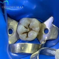 بسماية الشارع العام • حجز • واتساب