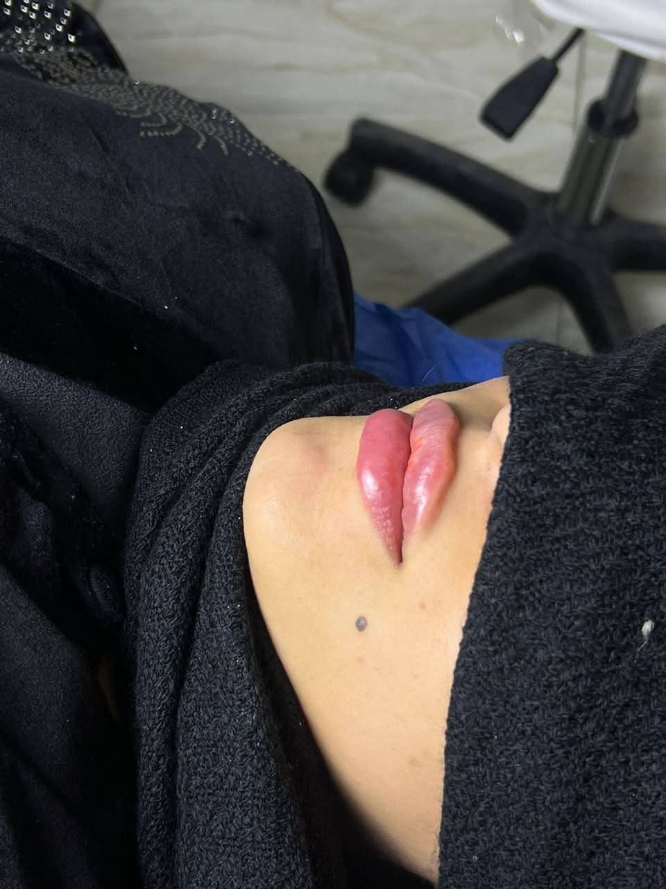 عروضنه الحلوه
فلر ديلوكس ب 50 الف
فلر براند لكوري ب 75
4 سيسي فلر 240
6 سيسي فلر 360
8 سيسي فلر480
10 سيسي فلر600


**إذا كنت صاحب هذا الإعلان وتريد حذفه لأي سبب، رجاءا أرسل رسالة إلى الدعم الفني**