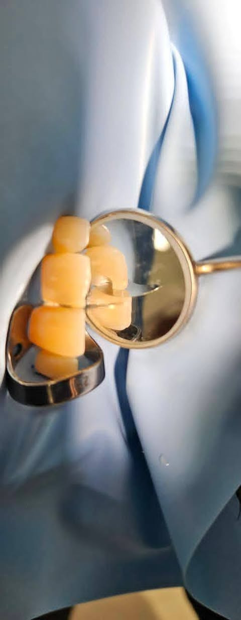 اي احد عنده اطفال جوة 14 سنة و يحتاجون حشوات اسنان او جلسات فلورايد  او قلع مجانا يراسلني خاص او واتس اب ***********
