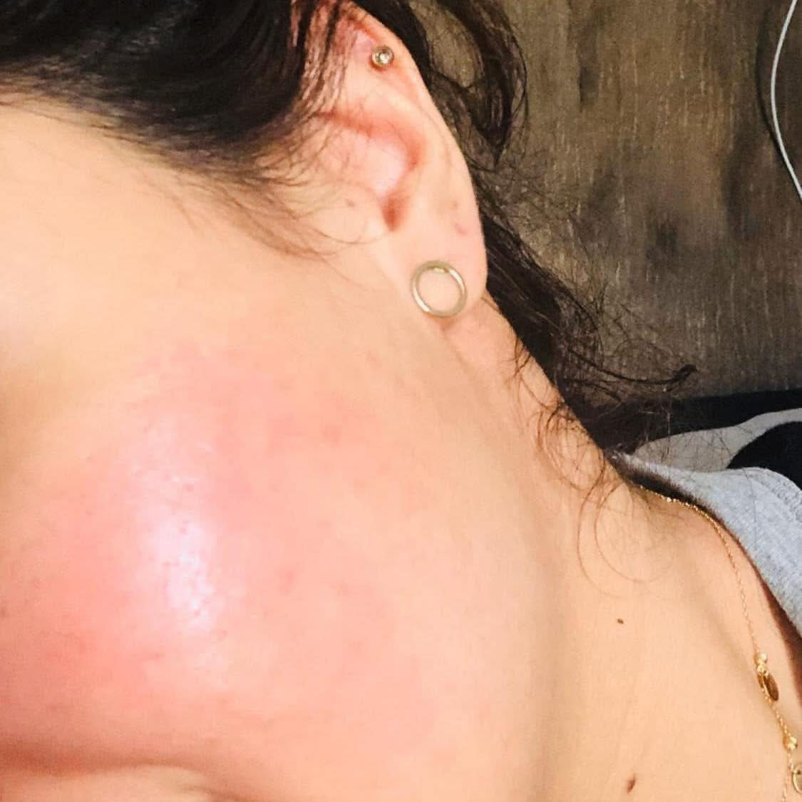 بشرتج تعبانة🥺
خلطه ملامح بريئة للوجه والرقبة  مجربه ومضمونه👇🥰
مجربه من قبل الكثير من زبائننا 🌺 
لاتترك اي اثر سلبي للبشره ولاتعود البشره كما كانت مابيها مواد ضاره مثل درمودين او مواد كيمياويه تضر البشره
*********** 
‏Tabark badea
تجارب الزبائن بالتعليقات مجربة ومضمونة 100%
