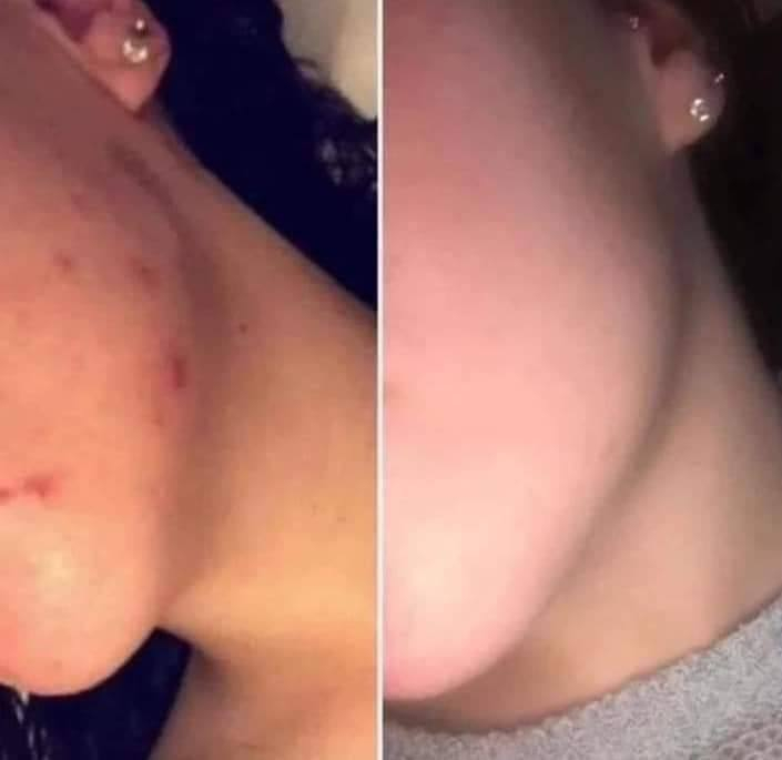 بنات عندي خبطه تبيض الوجه وتوخر النمش والكلف وتنعم البشره
وعندي خبطه تسمين الوجه وتبيض خال 3ايام ولي تحب تجي خاص ا***********
