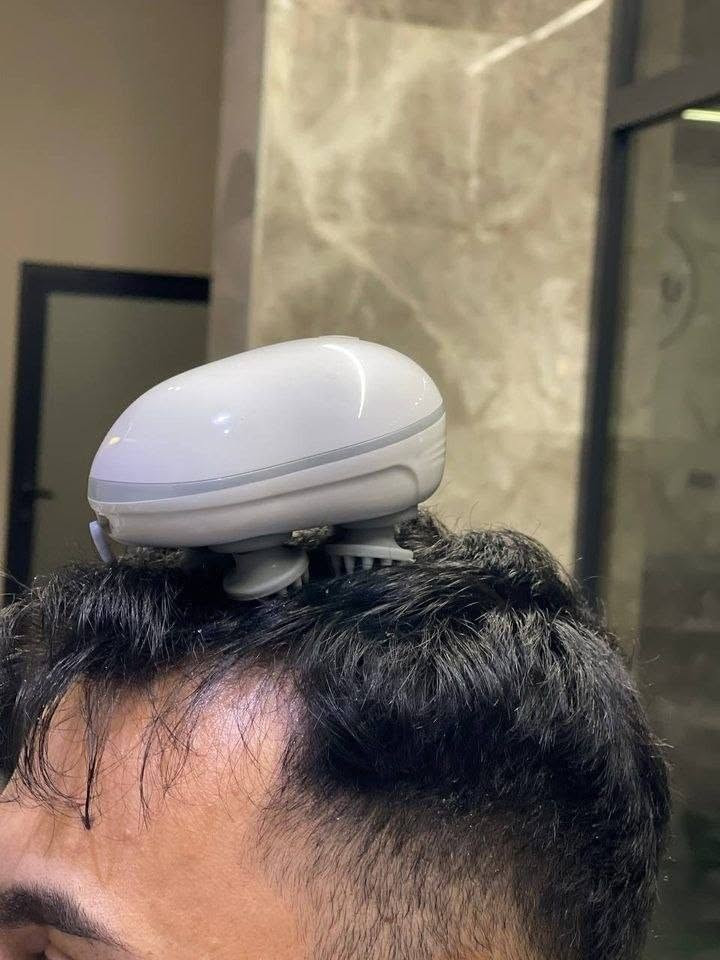 التواصل واتساب ***********
جهاز مساج فروة الرأس الذكي – Smart Scalp Massager

استمتع بتجربة استرخاء متكاملة مع جهاز مساج فروة الرأس الذكي المصمم لتدليك فروة الرأس وتحفيزها بلطف. يتميز بأربع رؤوس سيليكون ناعمة تحاكي حركة التدليك اليدوي، مما يساعد على تخفيف التوتر وتنشيط الدورة الدموية ومنحك شعوراً بالراحة والاسترخاء.

المميزات:

4 رؤوس سيليكون مرنة لتدليك  ومريح.

3 أوضاع تدليك تناسب احتياجاتك.

 .بطارية مدمجة قابلة لإعادة الشحن عبر USB.

.مؤقت ذكي للإيقاف التلقائي بعد 10 دقائق.

.يساعد على تنشيط الدورة الدموية في فروة الرأس.

يخفف التوتر والإجهاد بعد يوم طويل.

مناسب للاستخدام على فروة 
الرأس الجافة أو أثناء غسل الشعر

تصميم لاسلكي وخفيف الوزن لسهولة الاستخدام في أي مكان
محتويات العبوة:

جهاز مساج فروة الرأس الذكي.
كابل شحن USB.
دليل الاستخدام
السعر 14 الف
