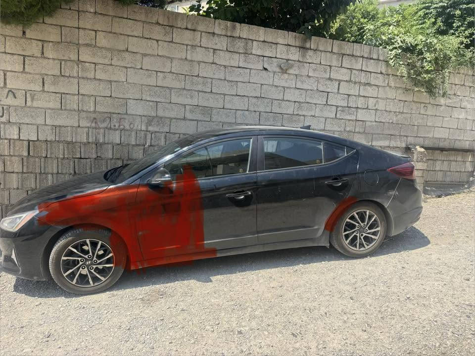 الینترا ٢٠٢٠ 
کیر بدو شرت
تزرة
بدون دواخل
بدون ئیرباک
١٠٨
وەتسئاب (***********)
