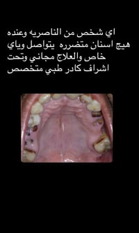 المحتاج قلع او حشوة ضوئية والعمل مجاني 07806179029