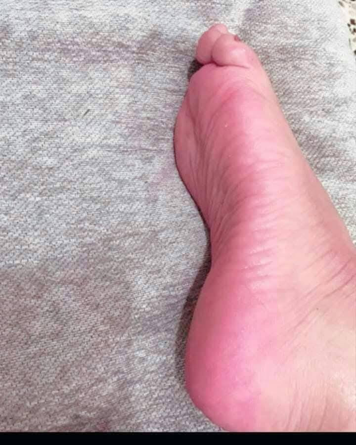 عمي بلاش  انطيجن خلطه  لتشققات او فطور قدم امانه الله من اول استخدام فرق وتنطي  وترطب. تورد ب3الاف فقط  تاخذيها وشوفي شغلها يخبل  وسعرها مناسب توصيل داخل الحسينيه متوفر يوصلج بنفس ليوم كميات محدوه


**إذا كنت صاحب هذا الإعلان وتريد حذفه لأي سبب، رجاءا أرسل رسالة إلى الدعم الفني**