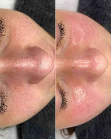 يعلن صالون ساندي للسيدات 
حف وجه كامل 7الف مع مقشر وجه 
قص شعر 7الف 
تنظيف بشره عادي 10الف 
تنظيف بشره عميق لجهاز الهيدروفشل 15الف ملكي
تنظيف قدم ملكي 15الف 
تنظيف قدم عادي 10الف 
معالج شعر قصير 15الف 
معالج للشعر الوسط 25الف
معالج للشعر الطويل 35الف 
معالج مسرح وبروتين شعر وبضمان 100 💯 
من ل40الف ل 150عرض حسب طول الشعر مع قصه شعر هديه ساررعووواا بل حجز 
تعليم العالي مدخل مجمع النور السكني ليس لدي فرع آخر ***********
***********
