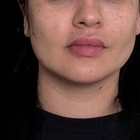 كل الي طلبو مني صور قبل وبعد. الشغلي. 07770474204