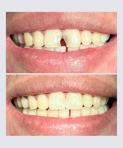 السلام عليكم  ، منو عنده هيج تسوسات ويكدر يجي يوم الاربعاء الساعة١٠ ونص الصبح انا اشتغلهن والعلاج مجاني تحت اشراف اطباء اختصاص 
فقط سعر الباص (رمزي جدا )
للتواصل والحجز واتساب :***********
