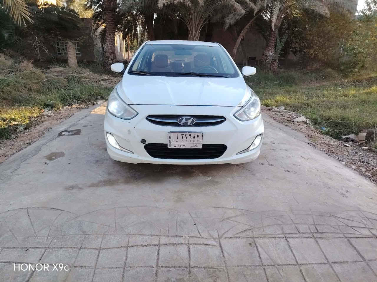 السلام عليكم سياره اكسنت 2016 مكفوله عده ربع جاملغ الكدام صبغ بدون فتح وتبديل محرك 1400 سياره جديده وجاهزه مشروع وطني راعيها جيراني مداور شوكت ما تريد اريد مراوس بألنترا مضلع واطي فرق ***********
