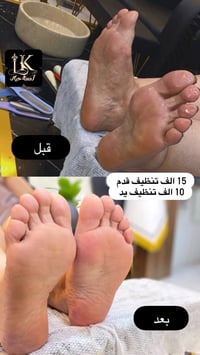 لمسة خيال • تنظيف قدم ملكي • موصل حي الوحدة