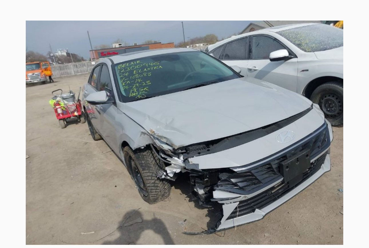 سلام عليكم
النترا 2024 جديدة السيارة وبحالة الوكالة لون مميز اسمنتي مواصفات فول عدا الكرسي مو كهرباء ماشية 13 ميل بأسمي تحويل مباشر وصورها تحكم كدامكم من نظافة ونصبة للاستفسار ***********
