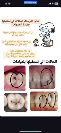 علاج اسنان مجاني • اطباء اختصاص • عيادات جامعة الكوفه