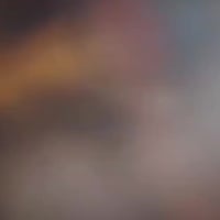 ستوته • موديل 2016 • اوراق اصولي