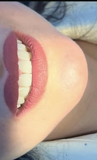 ✨ عيادة الدكتورة سميرة مهدي جاسم لطب الأسنان ✨  ابتسامتك أجمل معنا 😍  ...