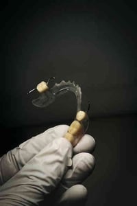 منو محتاج طقم تركيب جزئي الاسنانه ، عيادات جامعة العميد وفرت طقم اسنان...