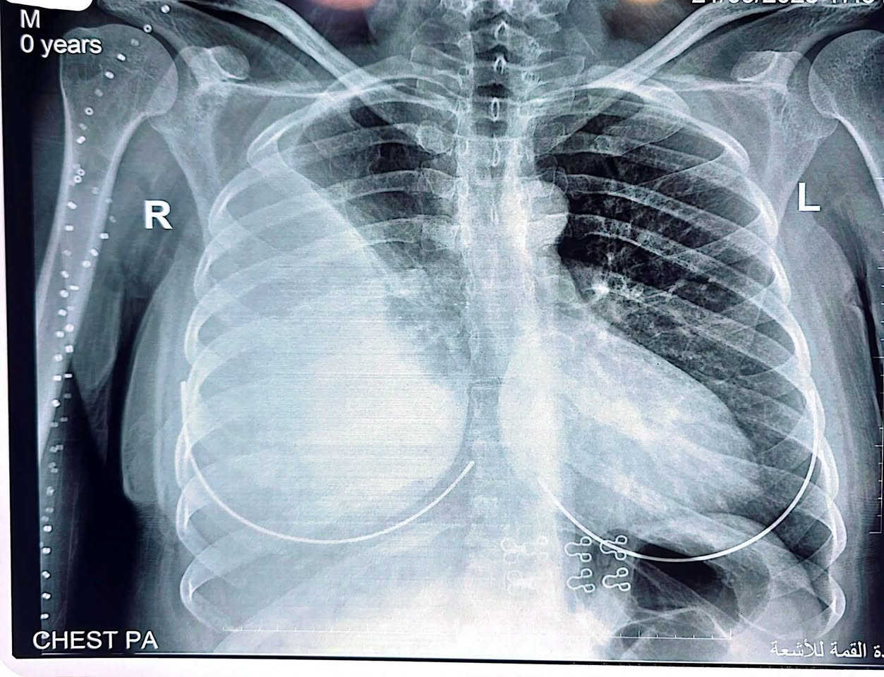 ♦️♦️تحية طيبة 
يتواجد الدكتور الاختصاص حسين الحسناوي
كل ايام الاسبوع 
📞📞***********
