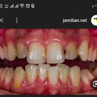 الي عنده مثل هيج تسوس يتواصل وياي والعمل مجاني  للتواصل ارسل رساله ع و...