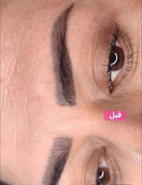 تحويل حاجب من ابلوك الى فايبروز الشعب مقابل سوق المدينه عيادات الزهراء...
