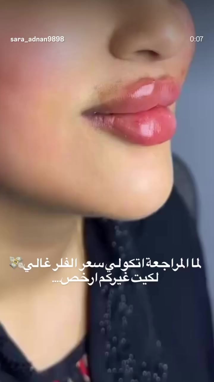 That’s sooo expensive! 🥺💸


**إذا كنت صاحب هذا الإعلان وتريد حذفه لأي سبب، رجاءا أرسل رسالة إلى الدعم الفني**