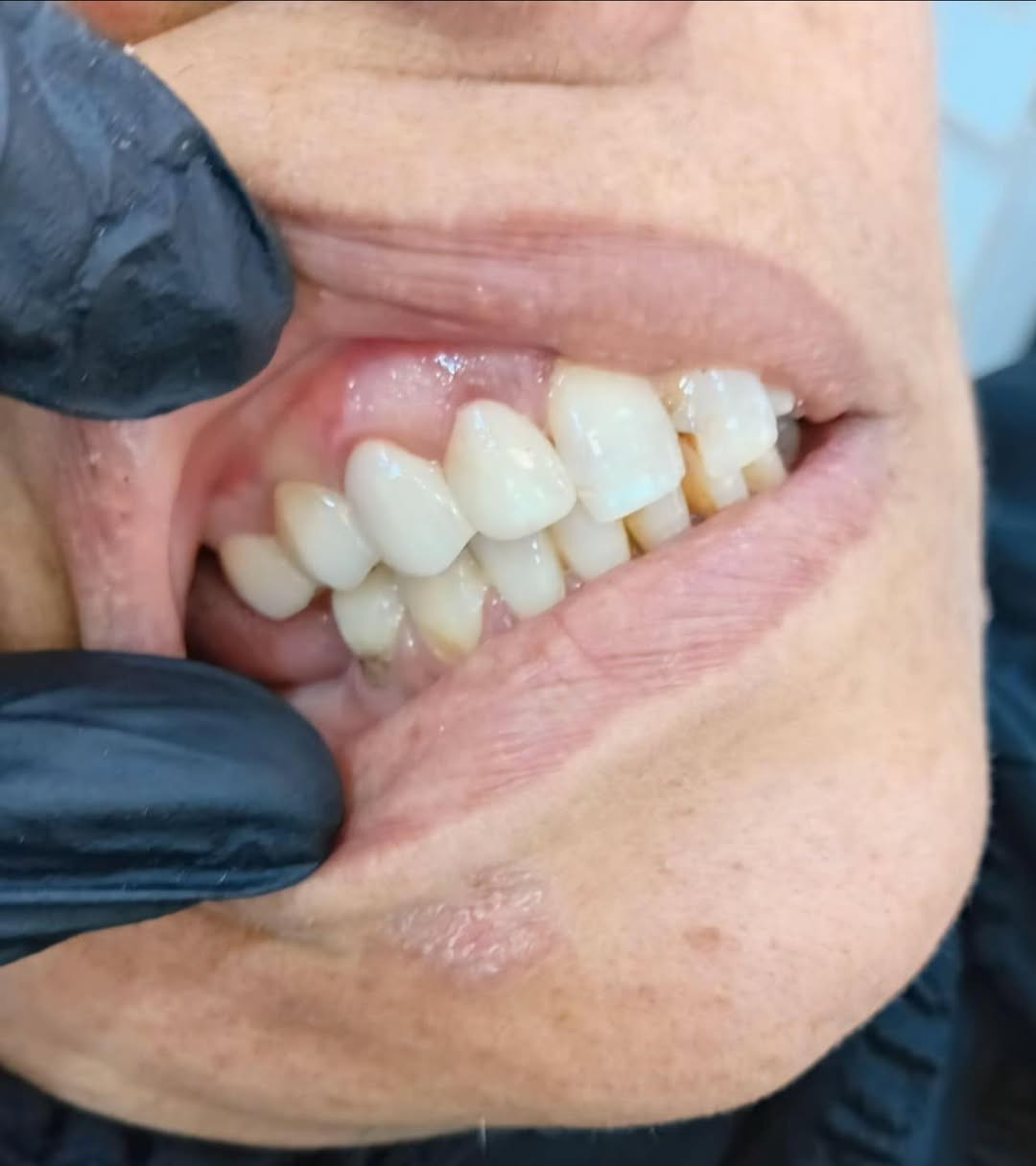 أجعل ابتسامتك افضل مع
 الدكتور الماهر منذر حبيب

📍متواجد يوميا في شهر رمضان المبارك مركز العالمي الطبي الخيري

من الساعة 8:00 صباحاً حتى الساعة 12:00 ظهراً
من الساعة 2:30 ظهراً حتى الساعة 5:30 قبل الافطار 
وبعد الافطار من 8:00 ليلاً والى 10:00 ليلاً

📍موقعنا : الناصرية قضاء النصر الصوب الكبير الفرع المقابل مصرف الرافدين

📲للحجز والاستفسار الاتصال
 على رقم قسم الأسنان ***********
