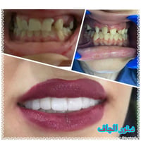 #بشرى ساره إلى مراجعينا الكرام #تعلن عيادتنا عن تخفيضات تصل إلى       ...