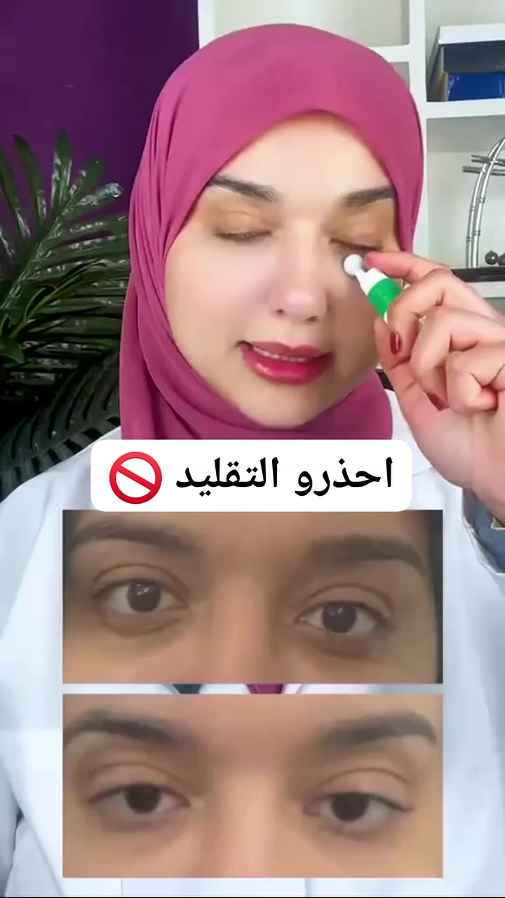 ‏🌱 vegan collagen eye serum سيروم العين بالكولاجين النباتي من  اكسس واي AXIS-Y 🌱(كوري الصنع🇰🇷)
منتج للعناية بالبشرة مصمم خصيصًا لمنطقة العين الحساسة، ويستهدف التجاعيد والهالات السوداء والانتفاخات. يعمل على تقليل ظهور الخطوط الدقيقة والتجاعيد، ويخفف من الهالات السوداء والانتفاخات، ويوفر ترطيبًا عميقًا وتغذية لمنطقة العين.

💢يحتوي على الكولاجين النباتي، وحمض الهيالورونيك الثلاثي، وخمسة أنواع من الببتيدات لتعزيز مرونة البشرة وترطيبها. مناسب لجميع أنواع البشرة، بما في ذلك البشرة الحساسة حول العينين.

✅الفوائد :-
🌟 يعزز مرونة البشرة ويقلل من ظهور الخطوط الدقيقة حول العين.
.حمض الهيالورونيك الثلاثي:
💧 يرطب بعمق ويحافظ على نعومة وإشراقة البشرة.
.مركب 5-Peptide:
🧬 يحفز إنتاج الكولاجين الطبيعي، مما يساعد في مكافحة علامات تقدم العمر.
• يقلل من الانتفاخ والهالات السوداء..
• يرطب البشرة بلطف ويتركها أكثر إشراقًا ونعومة.
• مزود بأداة تدليك معدنية تبرد البشرة وتعزز امتصاص المنتج.
#الاصلي المنشأ كوريا 🇰🇷💯
السعر 20 الف 
🚘يوجد خدمة توصيل لجميع محافظات العراق 3 الاف 🚘 #هالات #منتجات #توصيل #كربلاء #بغداد #النجف #ديالى #سليمانية #اربيل #البصرة #جميع_المحافظات #اصلي


**إذا كنت صاحب هذا الإعلان وتريد حذفه لأي سبب، رجاءا أرسل رسالة إلى الدعم الفني**