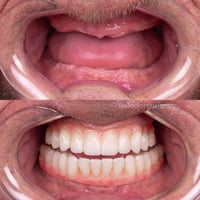 علاج مجاني • طقم كامل متحرك • بابل شارع الأربعين