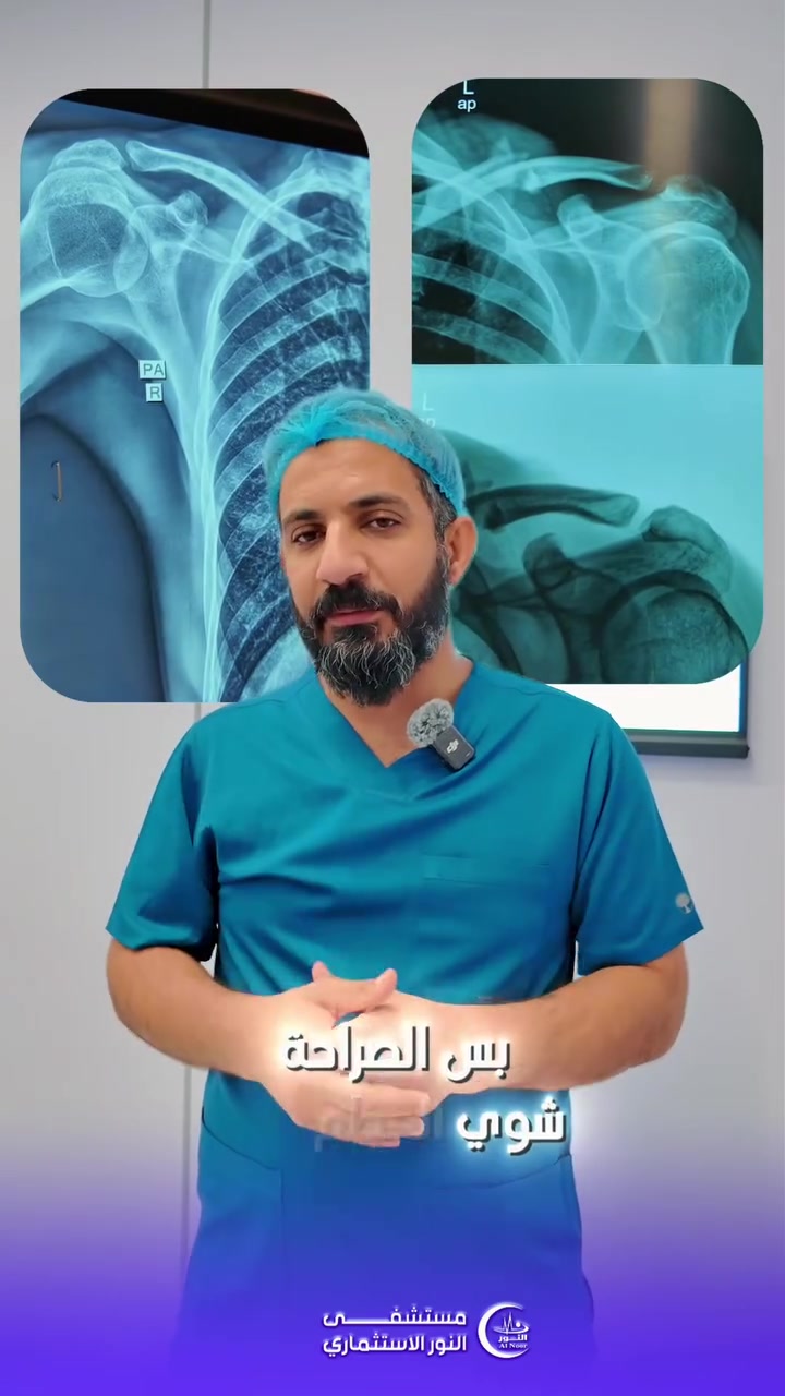 #مـسـتشـفـى_الـنور_الاسـتثـمـاري 

📍 أجرى الدكتور اثير عجيل الزيدي، أخصائي جراحة العظام والعمود الفقري 
📍عملية لمريض يعاني من كسر في عظم الترقوة مع تهشم في العظم 
📍وتم ربط العملية ببلاتين التيتانيوم وايضا تثبيت الكسر بواسطة صفيحة التيتانيوم والبراغي 

📍وبـخـبرة كـوادرنا الـطبيه تمـت العمـليه بـنجاح والمريض بصحة جيدة ✅️

⭕️ مسـتـشفى الـنور الاسـتثمـاري رعـاية طبيـة تلـيق بـكم 

📌للتواصل 
***********
***********
📌 العنوان / العراق _ الناصرية _ شارع النهر مجاور مدرسة الكرامة قرب الصابئة المندائيين @إشارة 
مستشفى النور الاستثماري
