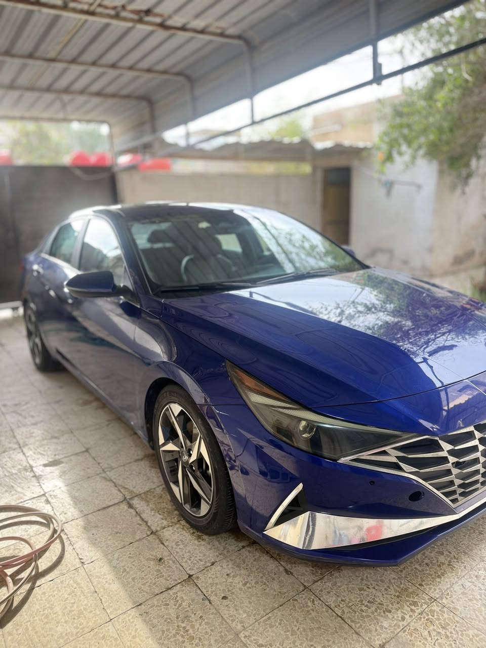 النتره 2022
حدثه من امريكه جملغ وبنيد وجملغ لثاني توحيد لون لاضربه وله معجون بيه تعدلي بل عرضنيه
ر قم بغداد موعوقين راح تخلص تتحول حره  
وكاله عامه بيه
لسعر 150$بيه مجال قليل
***********
