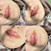 رسمة شفة • دكتورة نور • مرسومة بدقة