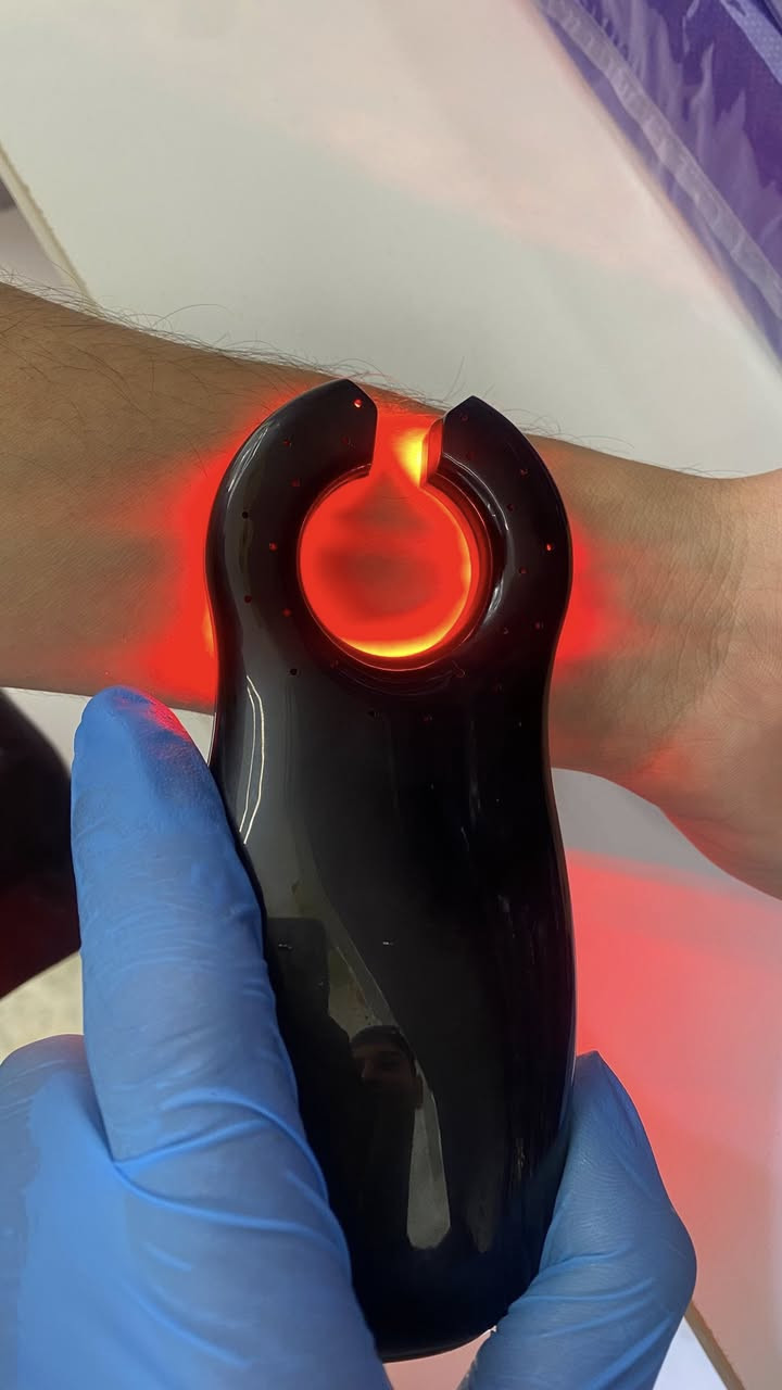 � إلى الكوادر الطبية الكرام من أطباء وممرضين وصيادلة
نوفر لكم الآن جهاز كاشف الوريد الحديث الذي يساعد على تحديد الأوردة بسرعة ودقة عالية، لتسهيل سحب الدم وتركيب الكانيولا خاصة للأطفال وكبار السن.
✨ المميزات:
 • رؤية واضحة للأوردة تحت الجلد
 • تقليل الألم وعدد المحاولات
 • مناسب للمستشفيات والعيادات والمختبرات
 • سهل الحمل والاستخدام
📍 متوفر الآن في محل العقل الطبي2 للأجهزة والمستلزمات الطبية
📍العنوان: [بغداد_قضاء الحسينية_شارع كراج الأسدي_مقابل أرض الاحلام]
📱للتواصل والأستفسار على الأرقام التالية : ***********)
(***********)
(***********)
#أجهزة_طبية #الحسينية #الحسينية_مطعم_الامير #مستلزمات_طبية #بغداد
