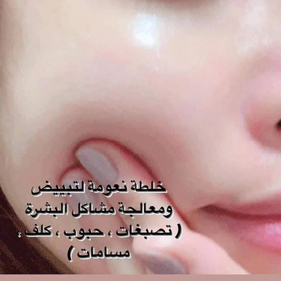 خلطه  لعشيبه طبيعيه 😍😍وربي خلال 7تيام فقط تشوفين فرق نصيحه  ذهبيه وربي جبتلكم البياض ونظاره ووتسوي البشره تلمع بخمس ايام فقط ⭐️لكل بنيه 👸🏻 وشاب تحسون  بشرتكم  مابيه نضاره 😔 وتحسه باهته😣 تستخدم خلطتنا عشبيه مابيه اي مضار كيمائيه   .تمتاز بقوام خفيف مخملي غير دهني ينحل مباشرة في البشرة. 🆗ممزوج بالمغذيات  وفيتامين B5 ليقوي سطح البشرة الوقائي ✅غنية بالغليسرين لتحسين قدرة البشرة على احتجاز الماء.💪🏻يمنح ترطيباً كثيفاً طويل الأمد لبشرة مرتاحة أكثر. 🙃تمنح بشرة أكثر نعومة ومرونة وتألقاً وصحة.  خالية  من البارابين ومختبره  من قبل أطباء الجلدية 😉تحتوي على فيتامين E وفلتر من الأشعة فوق البنفسجية💜 ليقي البشرة من الجذور الحرة وآثار الأشعة فوق  البنفسجيه😗 يعني ماكو تصبغات ولابقع بنيه ولاحبوب ولافرازات دهنيه


**إذا كنت صاحب هذا الإعلان وتريد حذفه لأي سبب، رجاءا أرسل رسالة إلى الدعم الفني**