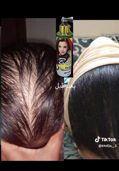 لي بغات شي حاجة توصل معايا فالخاص مرحبا


**إذا كنت صاحب هذا الإعلان وتريد حذفه لأي سبب، رجاءا أرسل رسالة إلى الدعم الفني**