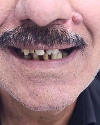 مركز الوارث • تجميل • د محمد السخي