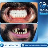 ✨ ابتسامتك تبدأ من هنا! ✨  في عيادتنا نقدم لك أفضل خدمات طب الأسنان بأ...