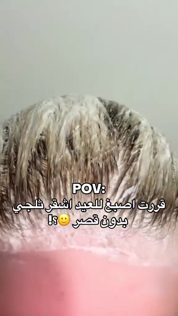 صبغةكلوتا لمعة صالونات وبكل سهولة! ✨
تريدين شعرج يضوي ولونه يجنن؟ صبغة كلوتا تنطيج لون غني وثباتية مو طبيعية، وتحافظ على نعومة شعرج حتى تطلعين بكشخة كاملة ومن البيت. 💁‍♀️
#صبغة_شعر #نيولوك #جمال #كشخة #عناية_بالشعر #صبغات


**إذا كنت صاحب هذا الإعلان وتريد حذفه لأي سبب، رجاءا أرسل رسالة إلى الدعم الفني**