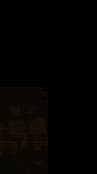 الابتسامة تحچي قبل لا تحچي انت 😉 نتيجة التبييض بالليزر من أول جلسة ✨ خ...