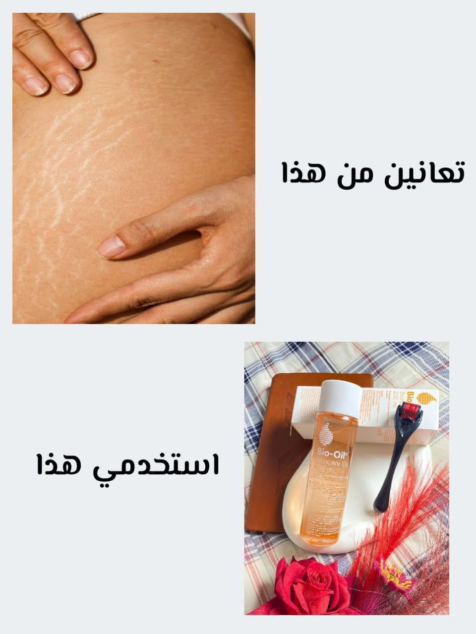 يتوفر الدينا جميع المنتجات الاصليه ✅💚 للمراسله ع الخاص ✅💚توجد خدمه توصيل


**إذا كنت صاحب هذا الإعلان وتريد حذفه لأي سبب، رجاءا أرسل رسالة إلى الدعم الفني**