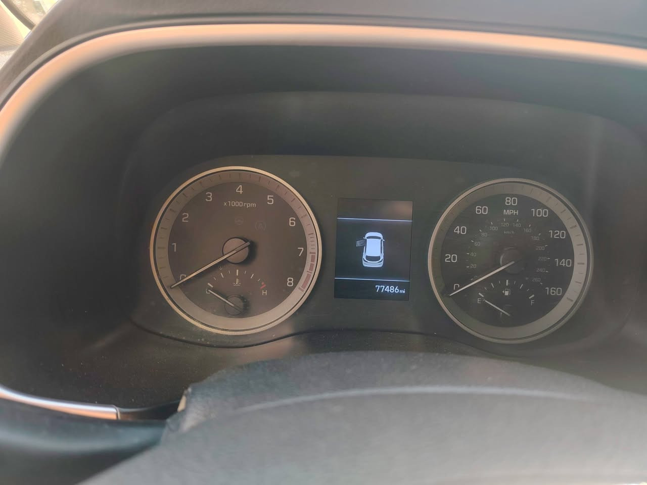 السلام عليكم توسان 2020وارد أمريكي حادثهه بنيد فقط سياره جديده جاهزه اي نقص ما بيهه مكينه كير حداديه جديد وضع شركه صبير ما نازل سنويه لل2027 تحويل ثاني يوم سعر 165بيهه مجال حك الجيه ***********
