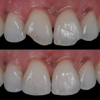 عروضض تكسر الدنيا لاهل الحسينيه وللناس الي تحتاج تسوي تقويم ومحتاره عي...