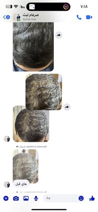 🪂عفيه ليش محد يرفعلي منشوري حسبوهي لوجه الله ورفعو المنشور حتى لو بحرف...