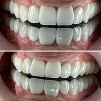 طب أسنان • علاج أسنان • عيادة أسنان • ابتسامة جديدة • تقسيط أسنان • أق...