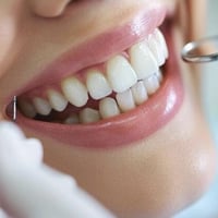 عيادات الجامعة الأمريكية • حشوات تجميلية • علاج مجاني