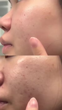 SKIN1004 • سيروم سنتيلا • تفتيح