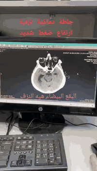 يتواجد يومي الاثنين والخميس في مجمع الكندي الطبي
#الدكتور الاختصاص🩺
#مصطفى حميد مجيد
☎️☎️0️⃣7️⃣8️⃣7️⃣7️⃣6️⃣3️⃣0️⃣8️⃣0️⃣6️⃣☎️☎️
♦️اخصائي في امراض الدماغ والحبل الشوكي والعضلات ♦️والاعصاب وامراض العمود الفقري والجلطات الدماغيه ♦️والصداع والشقيقه (الجمله العصبيه)
زميل المجلس العراقي للاختصاصات الطبية
شهادة بورد (دكتوراه )
M.B.CH.B.  F .I .B .M .S
وقت الدوام  من الساعة 2 ونص مساءً الى الساعة 7 مساءً💢.
_شارع الأطباء الفرع الثاني مجمع الكندي الطبي مقابل مجمع القمه الطبي .
_للحجز والاستفسار الاتصال على الرقم ***********☎️
