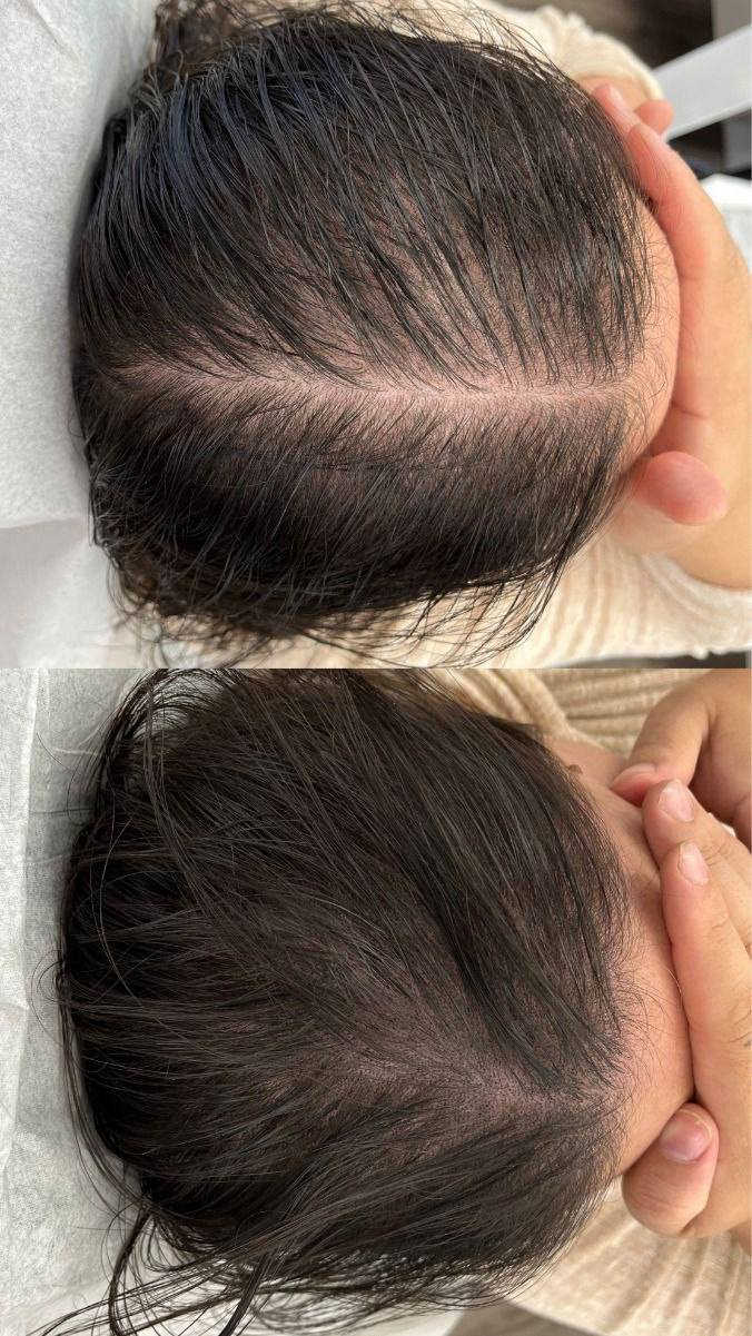 الحل معه مشاكل الشعر
عرض اكليل الجبل خرافي لمعالج الشعر من التلف والتصاقط 
#مشاهير #Celebrity #Influencer #Viral #اكسبلور


**إذا كنت صاحب هذا الإعلان وتريد حذفه لأي سبب، رجاءا أرسل رسالة إلى الدعم الفني**