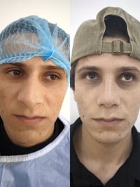 خشمك مو عاجبك؟ 🤔 ودك بملامح متناسقة تبرز جمالك؟ ✨ مركز الشرق الأوسط لل...