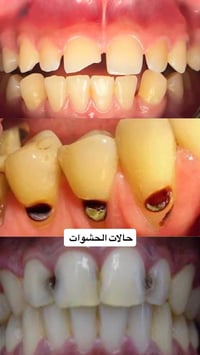 عيادة اسنان • طب اسنان • معالجة اسنان • قلع اسنان • حشوات ضوئية • تنظي...