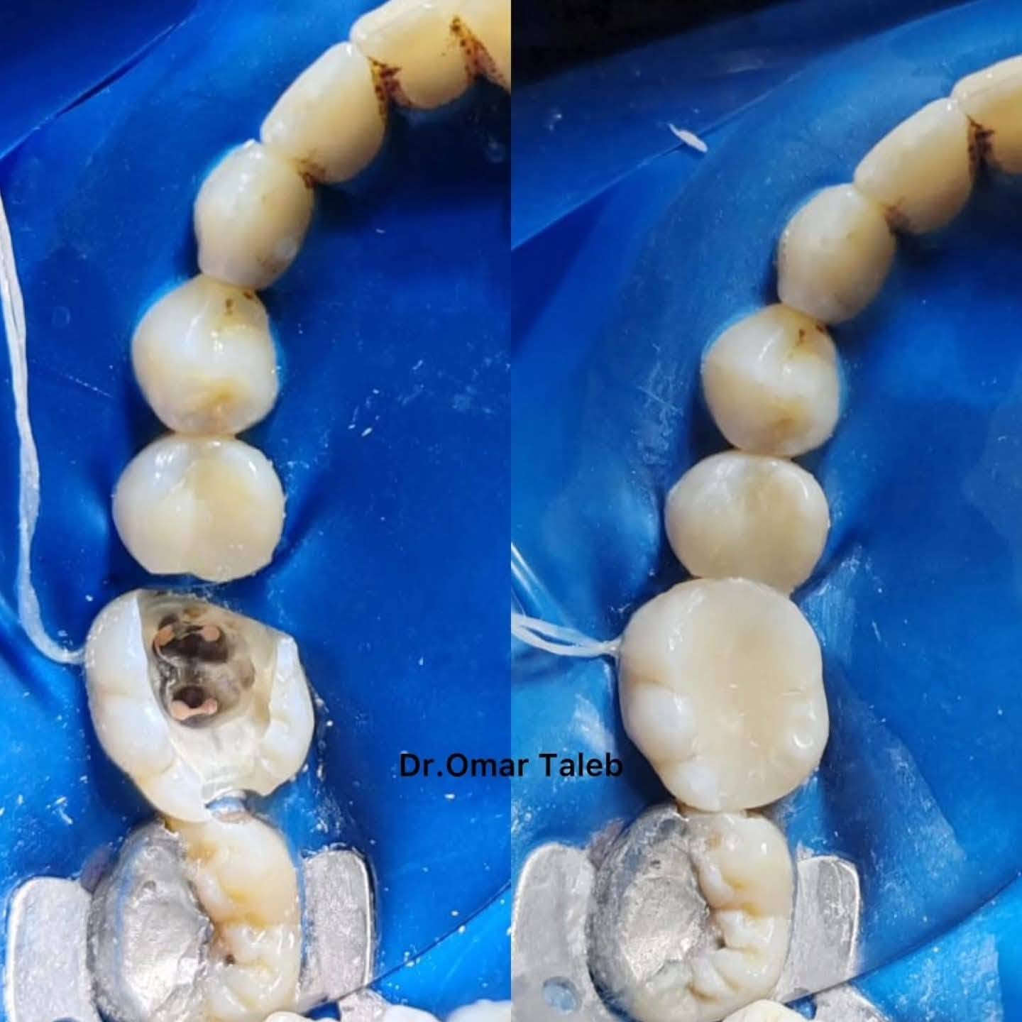 عيادة الدكتور عمر طالب    ( الاول ع بغداد )
طب وجراحة الاسنان 
الطارمية  شارع البعث  داخل الفرع خلف أسواق عسل 
رقم العيادة / ***********   
ملاحظة   يكون الحجز قبل يوم  يبداء من الساعة ١١ صباحا
